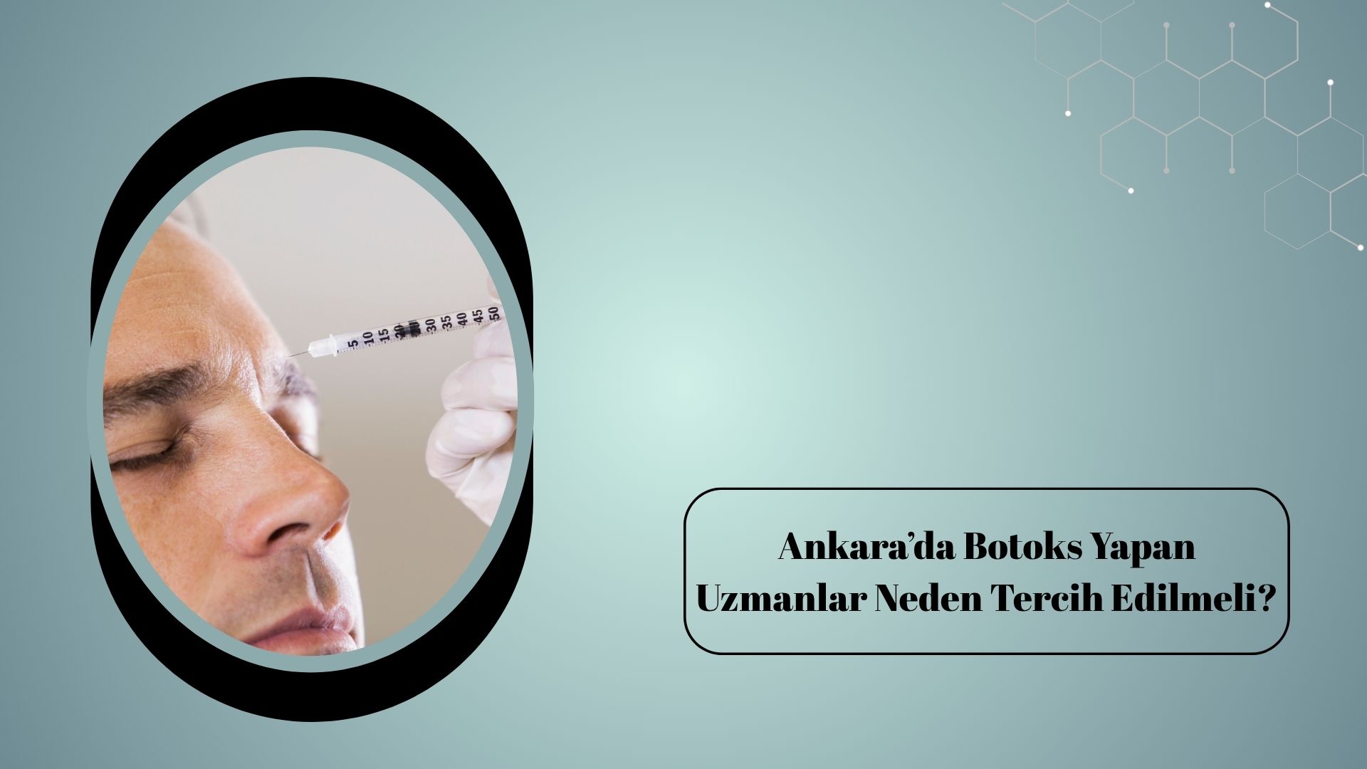 Ankara’da Botoks Yapan Uzmanlar Neden Tercih Edilmeli?