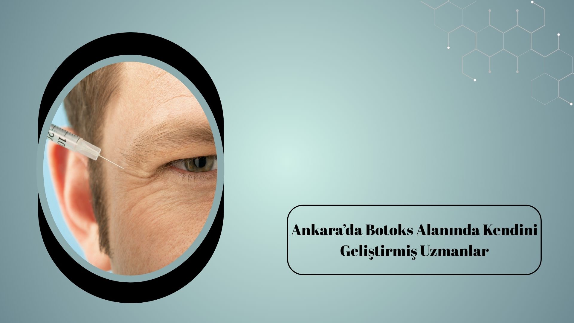 Ankara’da Botoks Alanında Kendini Geliştirmiş Uzmanlar