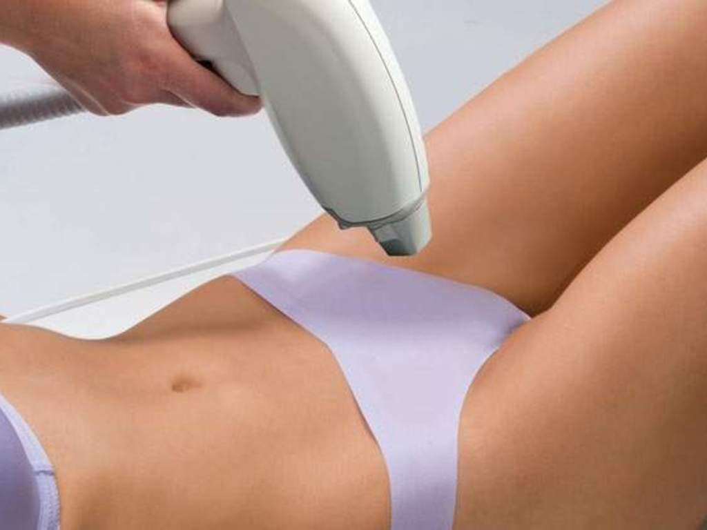 kizilay genital bolge beyazlatma yaz doneminde planlanir mi