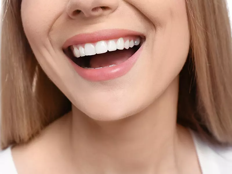 ankara gummy smile botoksu sonrasi dikkat edilmesi gerekenler